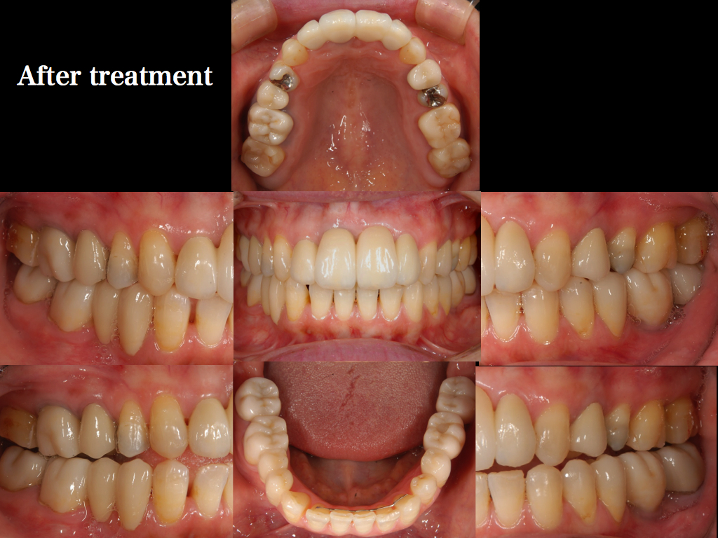 治療後画像01